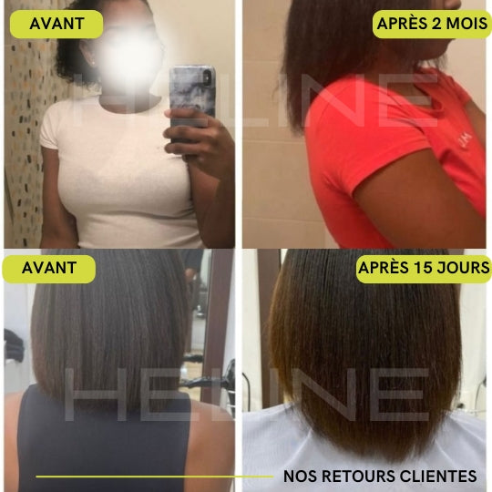 Huile Heline - Pousse De Cheveux