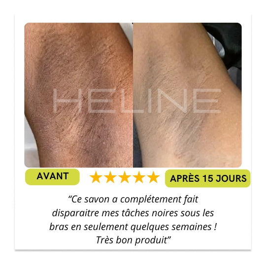 Lot de 2 Savons Unifiants Anti-Taches et Zones Sombres