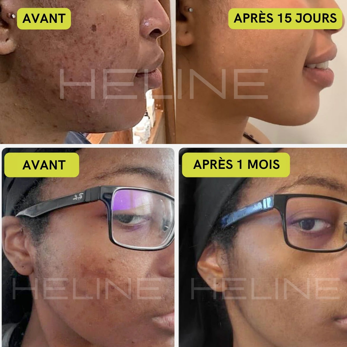 Lot de 2 Savons Unifiants Anti-Taches et Zones Sombres
