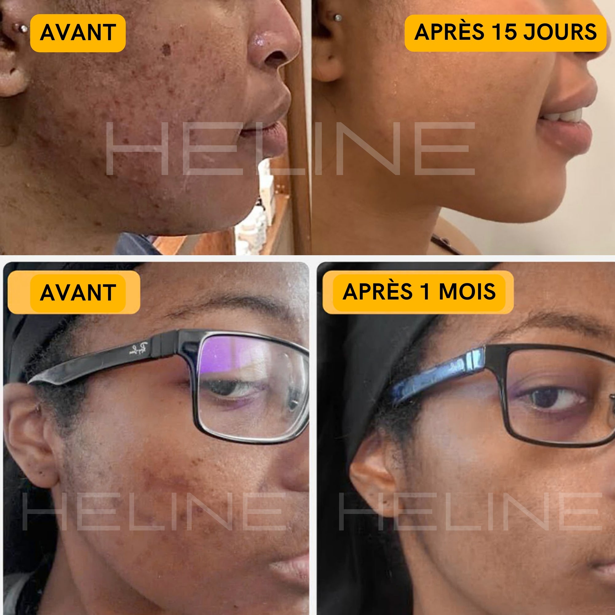 Masque Pure Éclat Anti-Imperfections & Super Glow