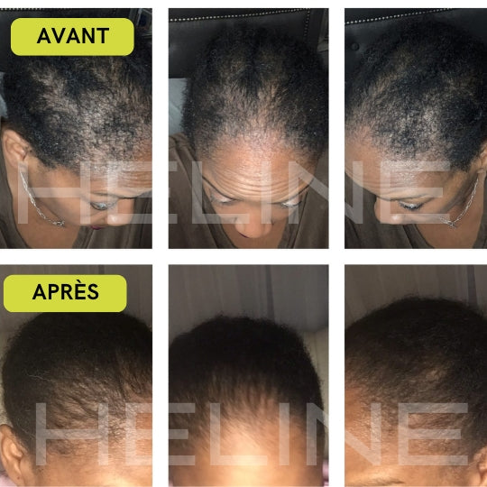 Shampoing & Après Shampoing - Gamme Pousse De Cheveux